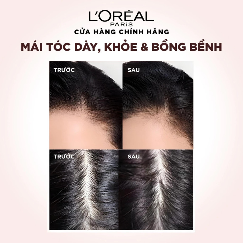 Review Bộ đôi Dầu Gội Xả L'Oreal Paris Elseve Full Resist 440ml – Giải Pháp Cho Tóc Gãy Rụng - Hinh 2